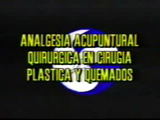 Analgesia acupuntural en Cirugía Plástica y Quemados