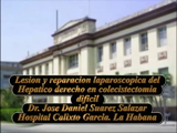 Lesión y reparacion del hepatico derecho por laparoscopia