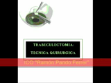 Trabeculectomía, técnica quirúrgica 